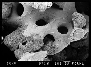 view SEM bone, showing new trabeculae and HA