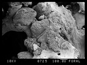 view SEM new bone around HA, lower part eroding