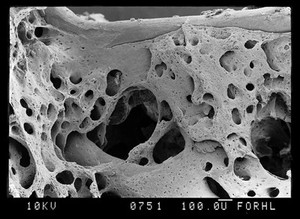 view SEM bone, new trabeculae connecting to old