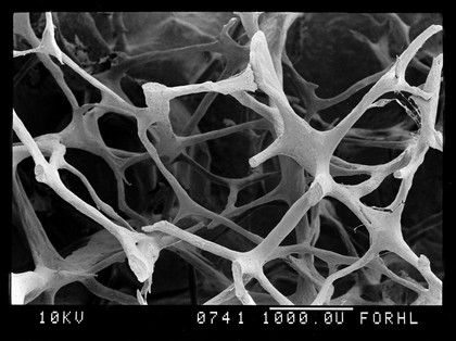 SEM old osteoporotic bone