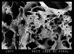 view SEM bone, sawn surface + fracture face