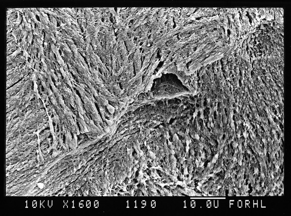 SEM of subchondral bone