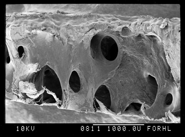 SEM of subchondral bone, full thickness