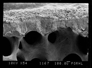 view SEM of subchondral bone