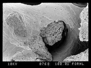 view SEM bone, eroded surface and new bone