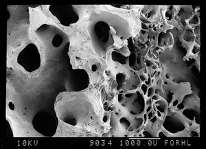 view SEm old bone with hole and new trabeculae