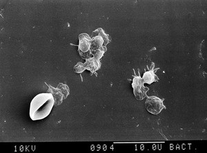 view SEM sheet of new bone forming