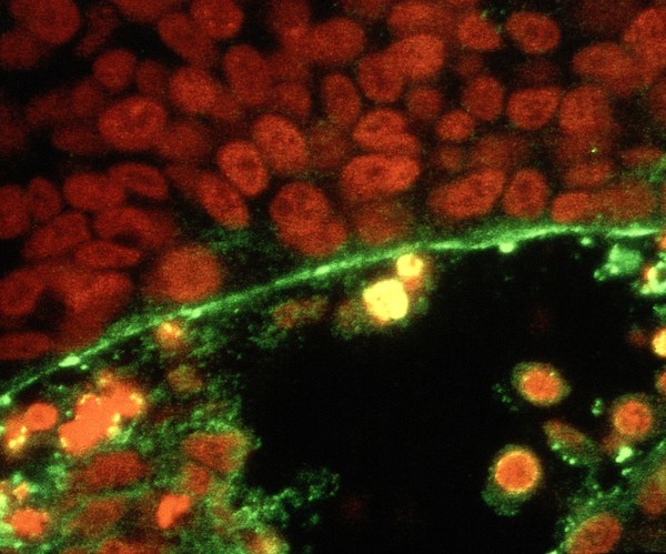 Embryonic wound healing