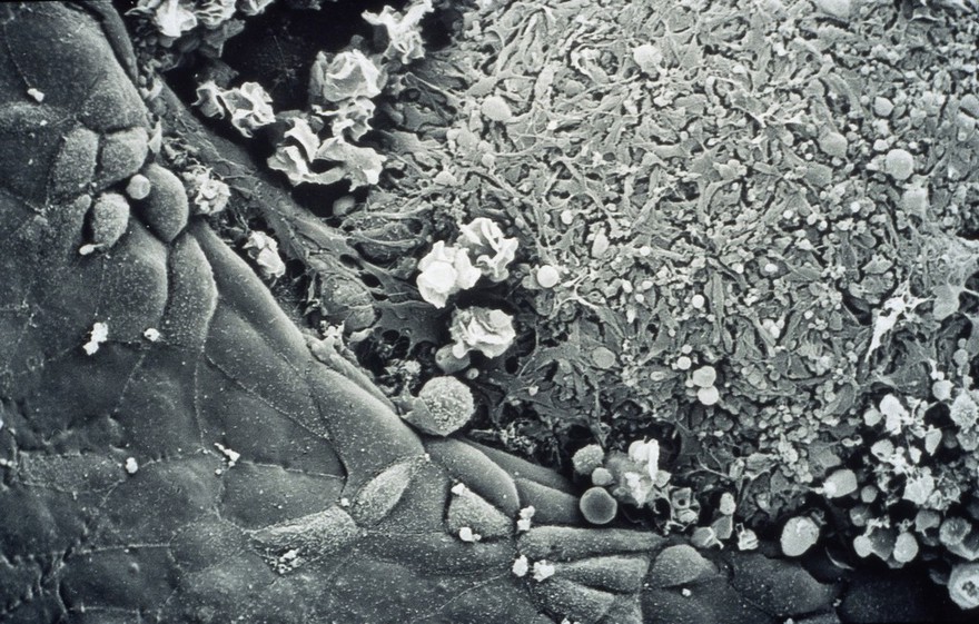 embryo wound healing SEM
