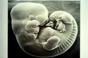 view SEM of mouse foetus