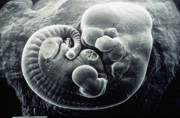 SEM of wounded mouse foetus