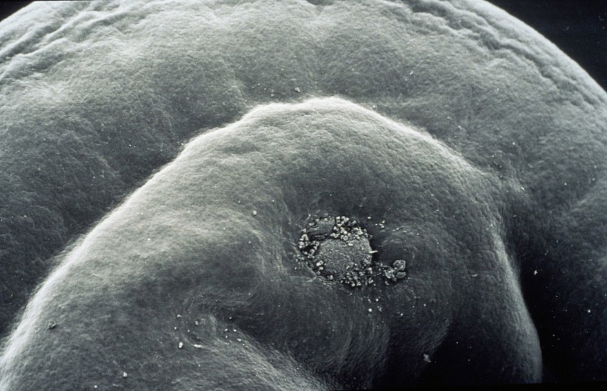 embryo wound healing SEM