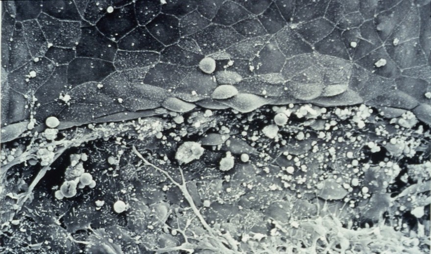embryo wound healing SEM