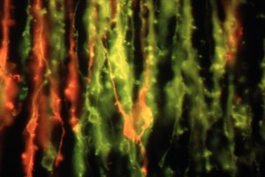 view Fluorescent cranial nerves