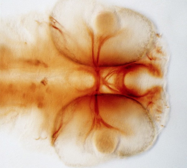 Zebrafish optic chiasm