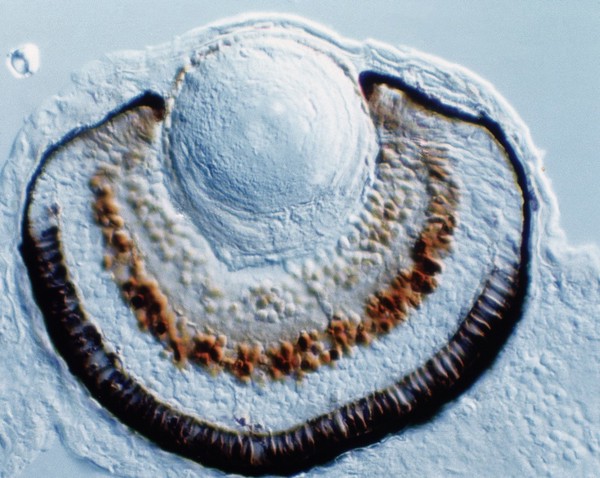 Zebrafish eye development
