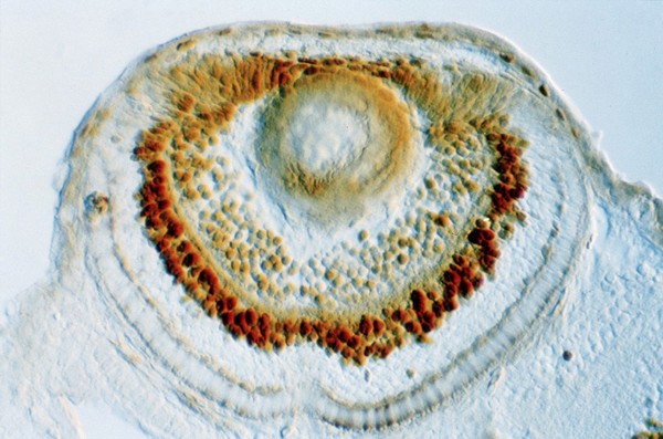 Zebrafish eye development