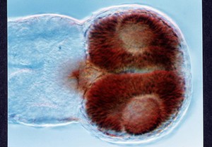 view Zebrafish eye development