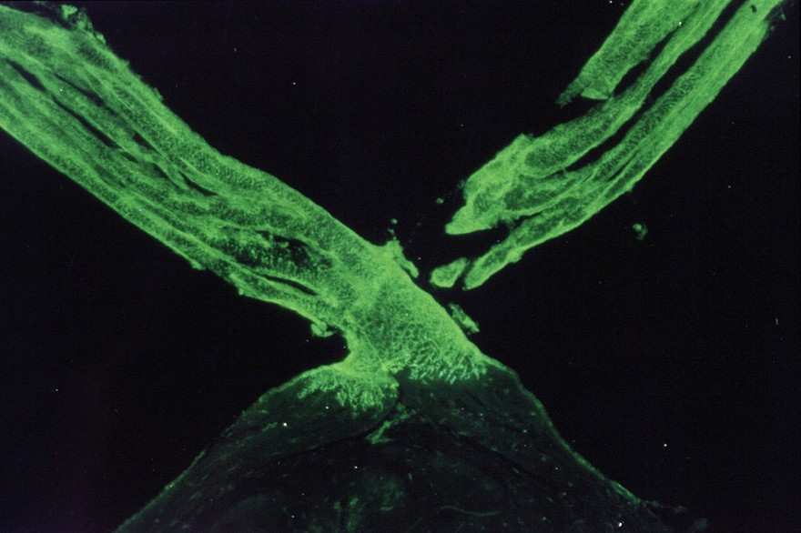 Zebrafish optic chiasm