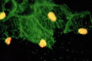 view Zebrafish optic chiasm