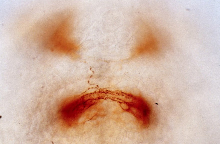Zebrafish optic chiasm