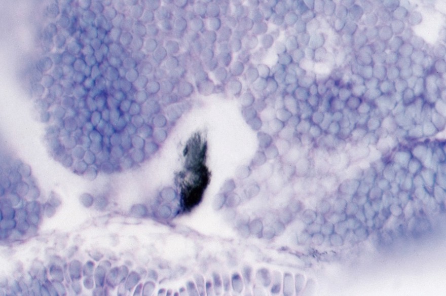 Zebrafish optic chiasm