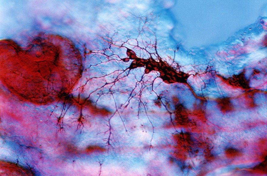 Zebrafish embryo neurone