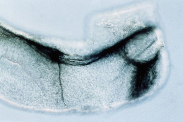 Zebrafish eye development