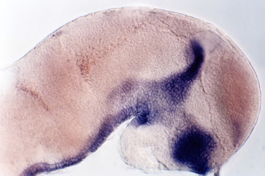 Zebrafish eye development