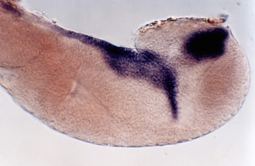 Zebrafish eye development