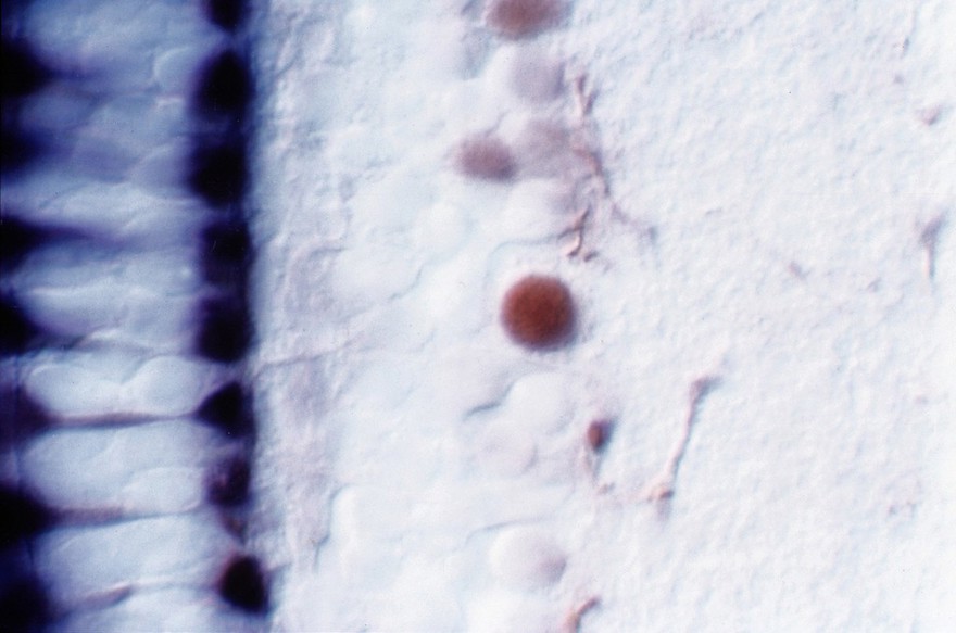 Zebrafish eye development