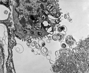 view Surfactant in newborn lung