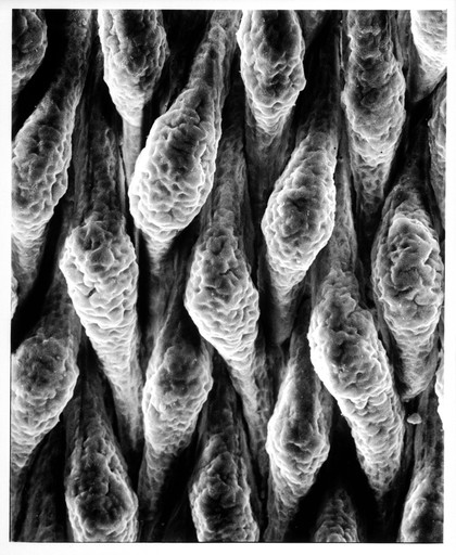 Inner surface of ileum