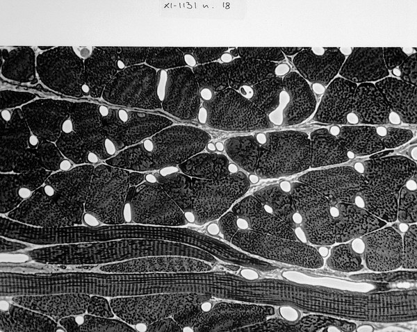 Section through tongue