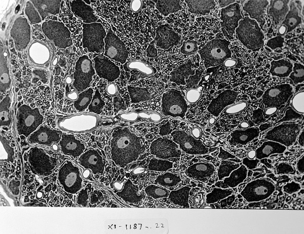 Section of ganglion