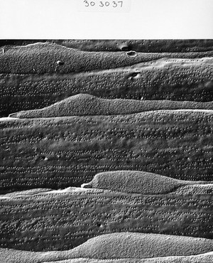 view Freeze-fracture of muscle