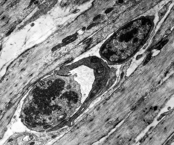 TEM of capillary
