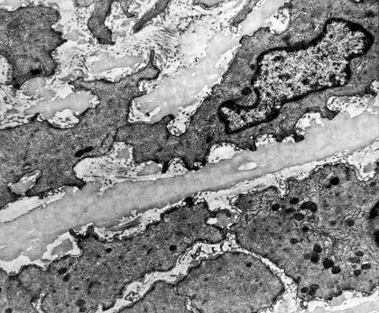 TEM of vascular muscle