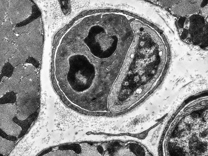 TEM of cardiac capillary