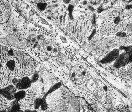 TEM of cardiac muscle