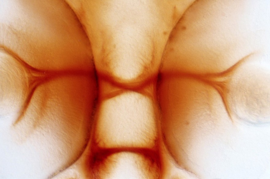 Zebrafish optic chiasm