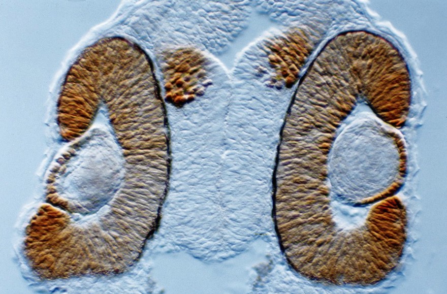 Zebrafish eye development