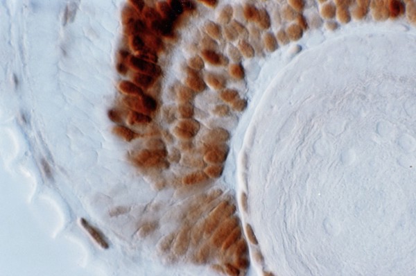 Zebrafish eye development