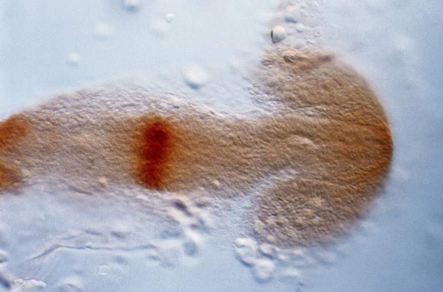 Zebrafish eye development