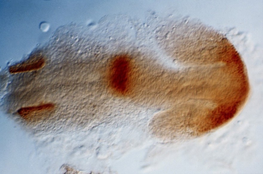 Zebrafish eye development