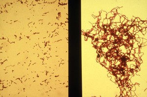 view aggregation of strep. mutans by antibody