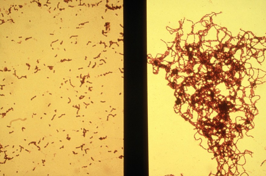 aggregation of strep. mutans by antibody