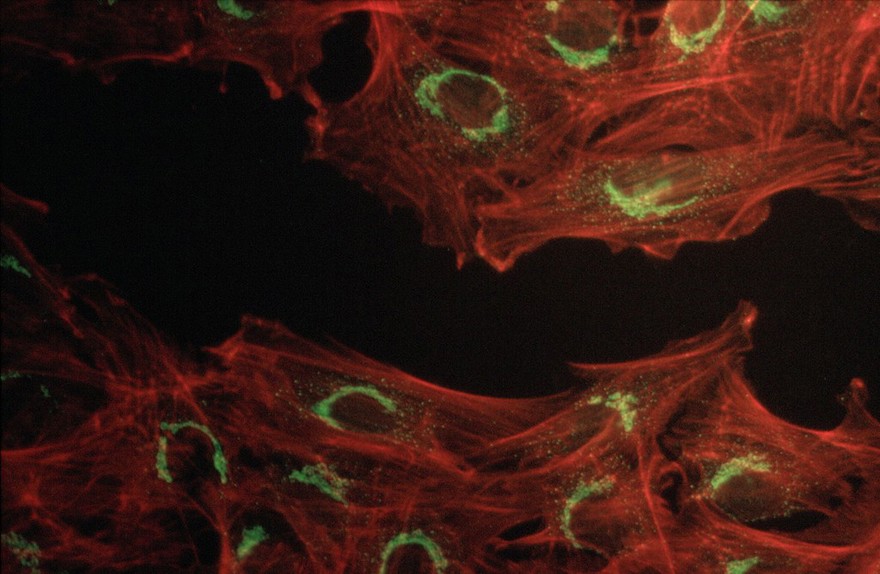 Fibroblasts showing actin & Golgi apparatus