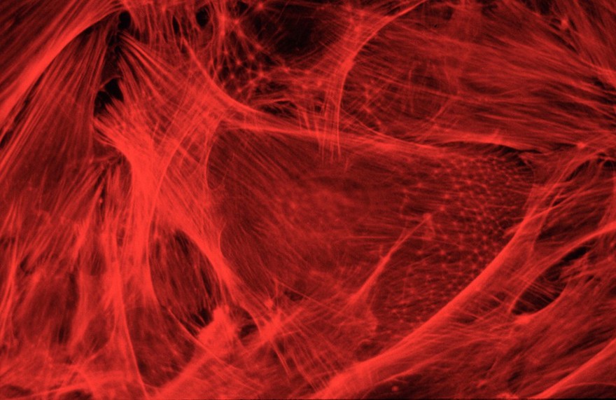 Actin in rat embryo fibroblasts