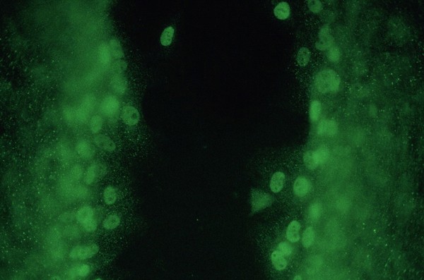 c-fos in wounded fibroblast monolayer